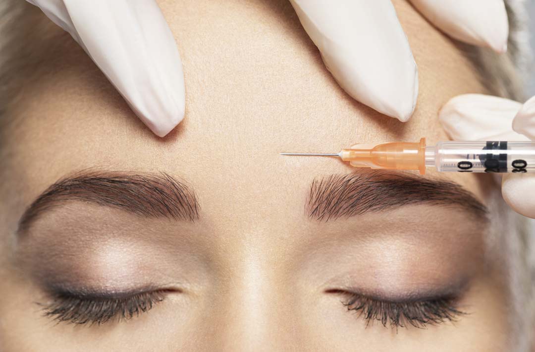 Faltenbehandlung mit Botox beim Hautzentrum Burgdorf