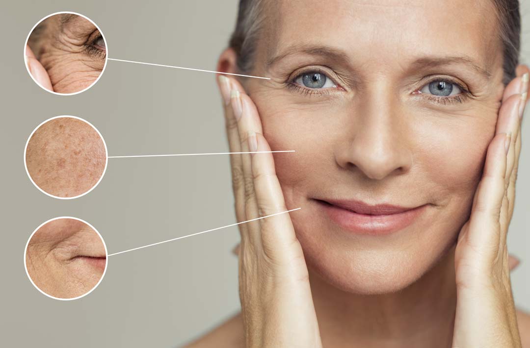 Ästhetische DermatologieBotoxHyalyronsäureJuvéderm®BurgdorfBurgwedel Hautzentrum Burgdorf